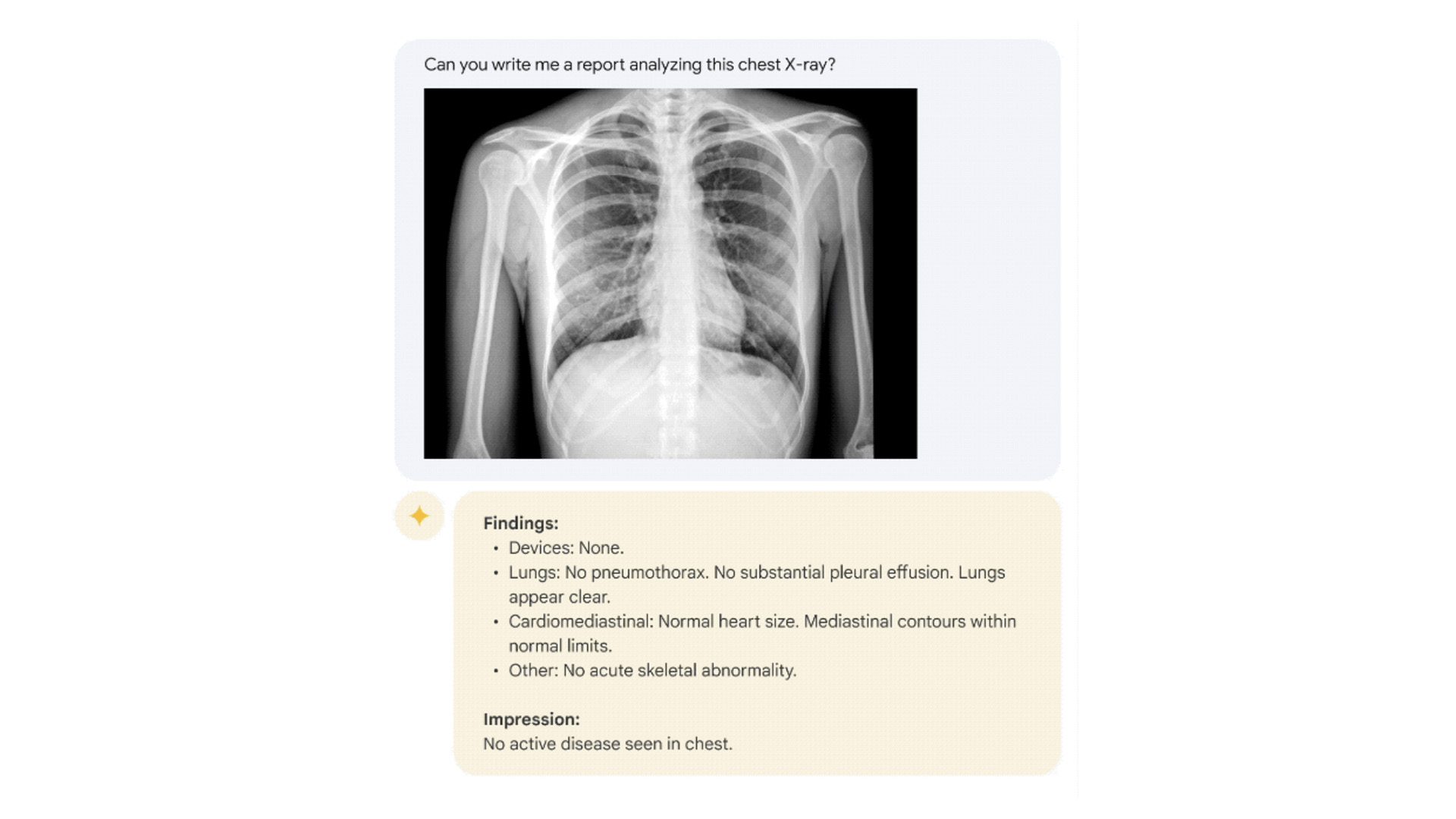 Example that reflects early exploration of Med-PaLM 2's future capabilities