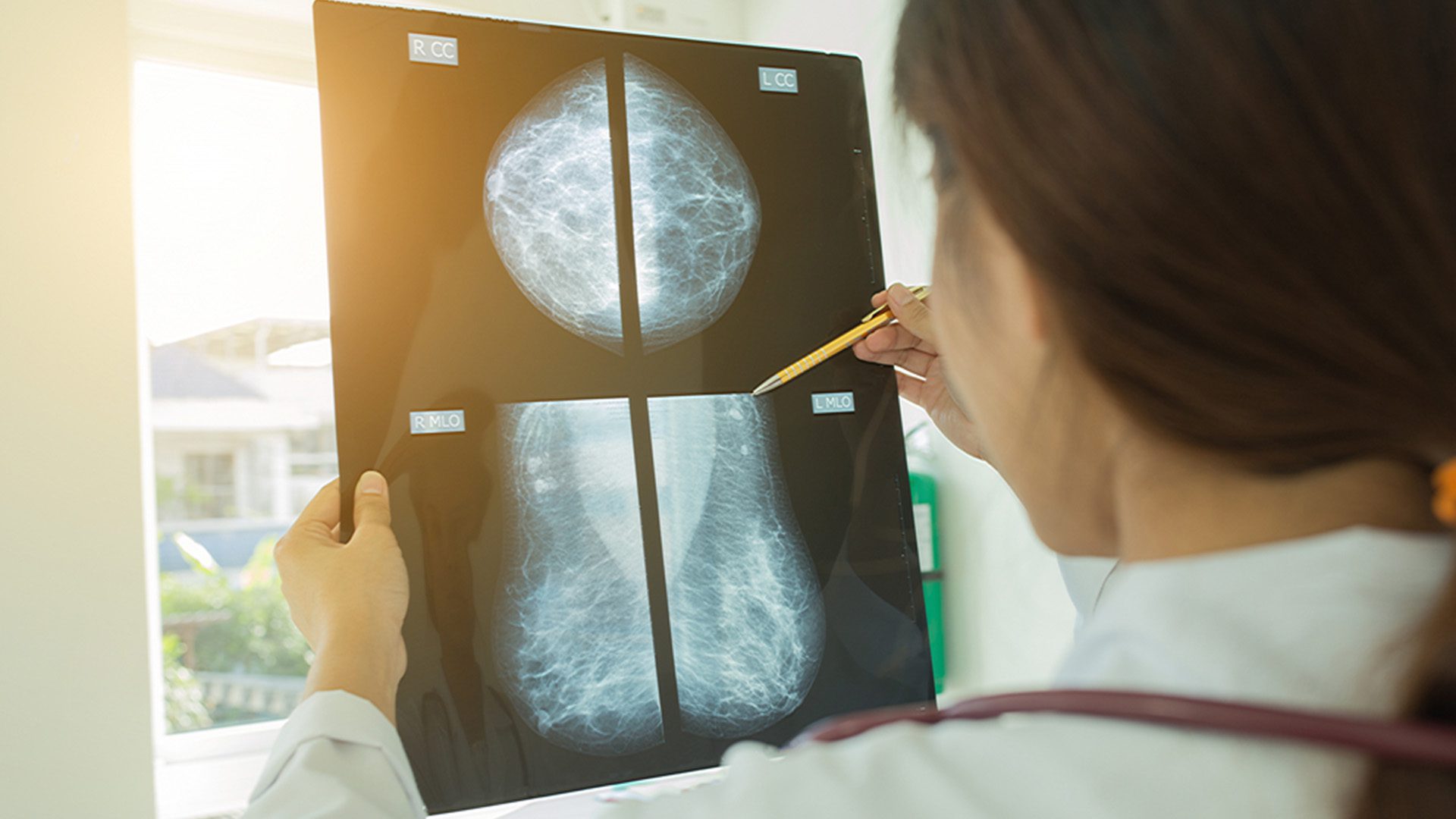 Radiologist Interprets Breast Cancer Screening
