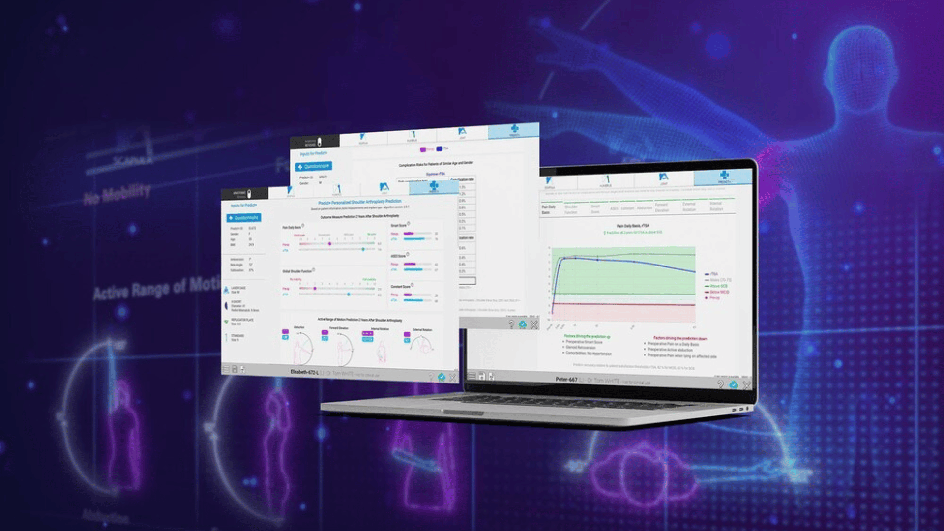 Exactech Unveils Next Generation of Predict+®, the First Machine Learning Tool for Predictive Outcomes in Shoulder Replacement Surgery Exactech Unveils Next Generation of Predict+®, the First Machine Learning Tool for Predictive Outcomes in Shoulder Replacement Surgery