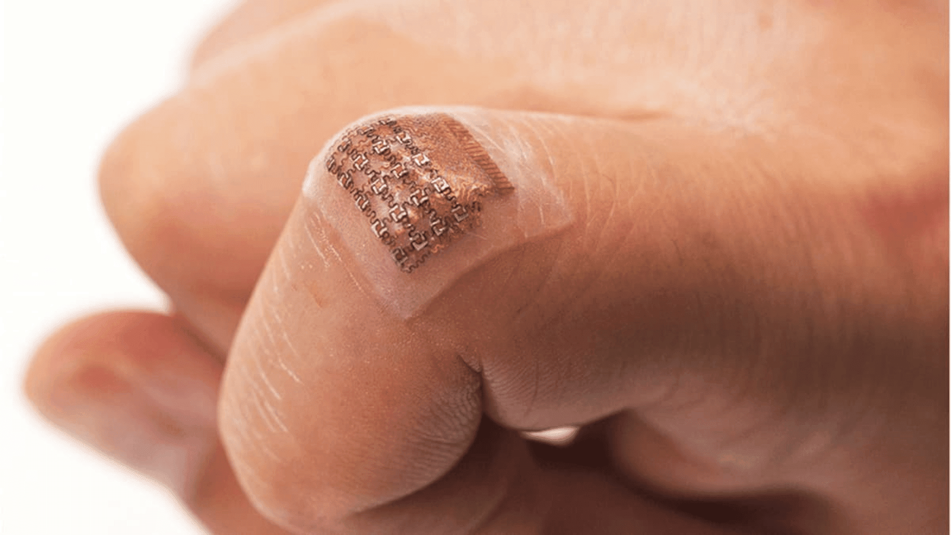 Skin-mounted electronic patch on a fingertip (representational image) National Institutes of Health