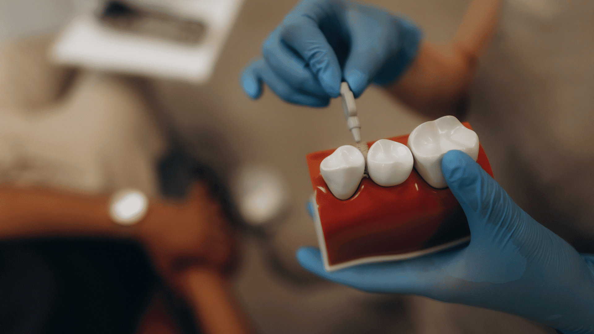 Dental implant representational image; Photo: Roman Fenton:Shutterstock