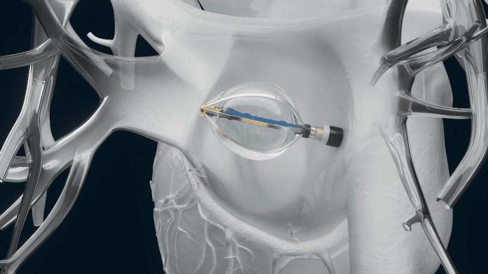 abbott tomorrows world today beat by beat