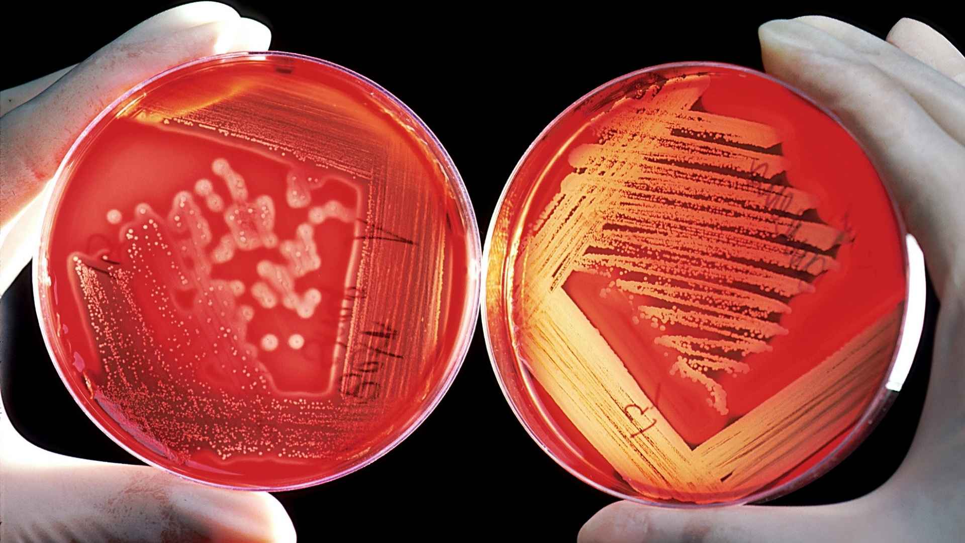 agar art