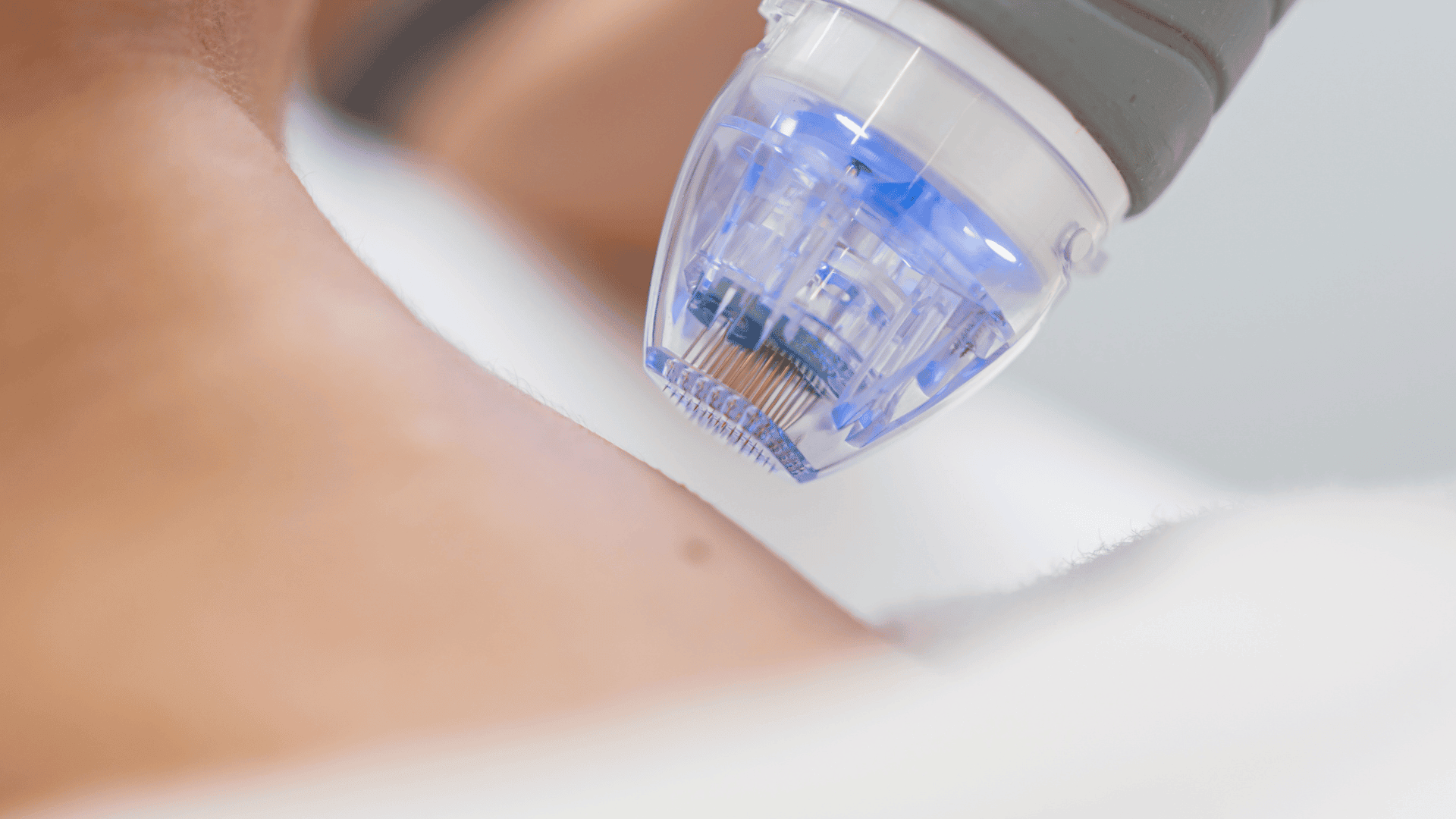 microneedle