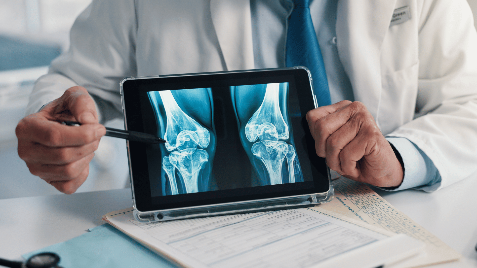 X-Ray